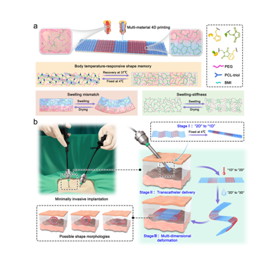 A 4D printed hydrogel scaffold suitable for minimally invasive implantation